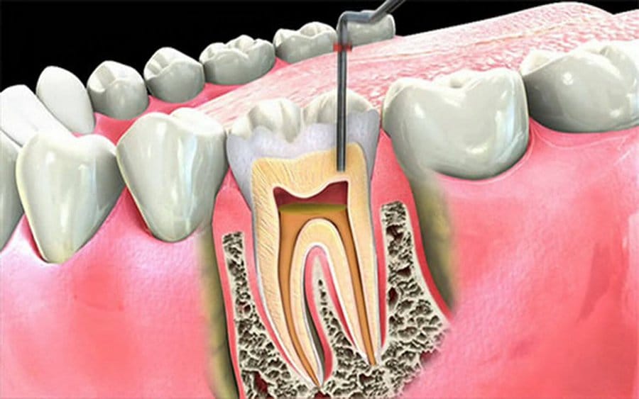 Dental merkez ağız ve diş sağlığı merkezi