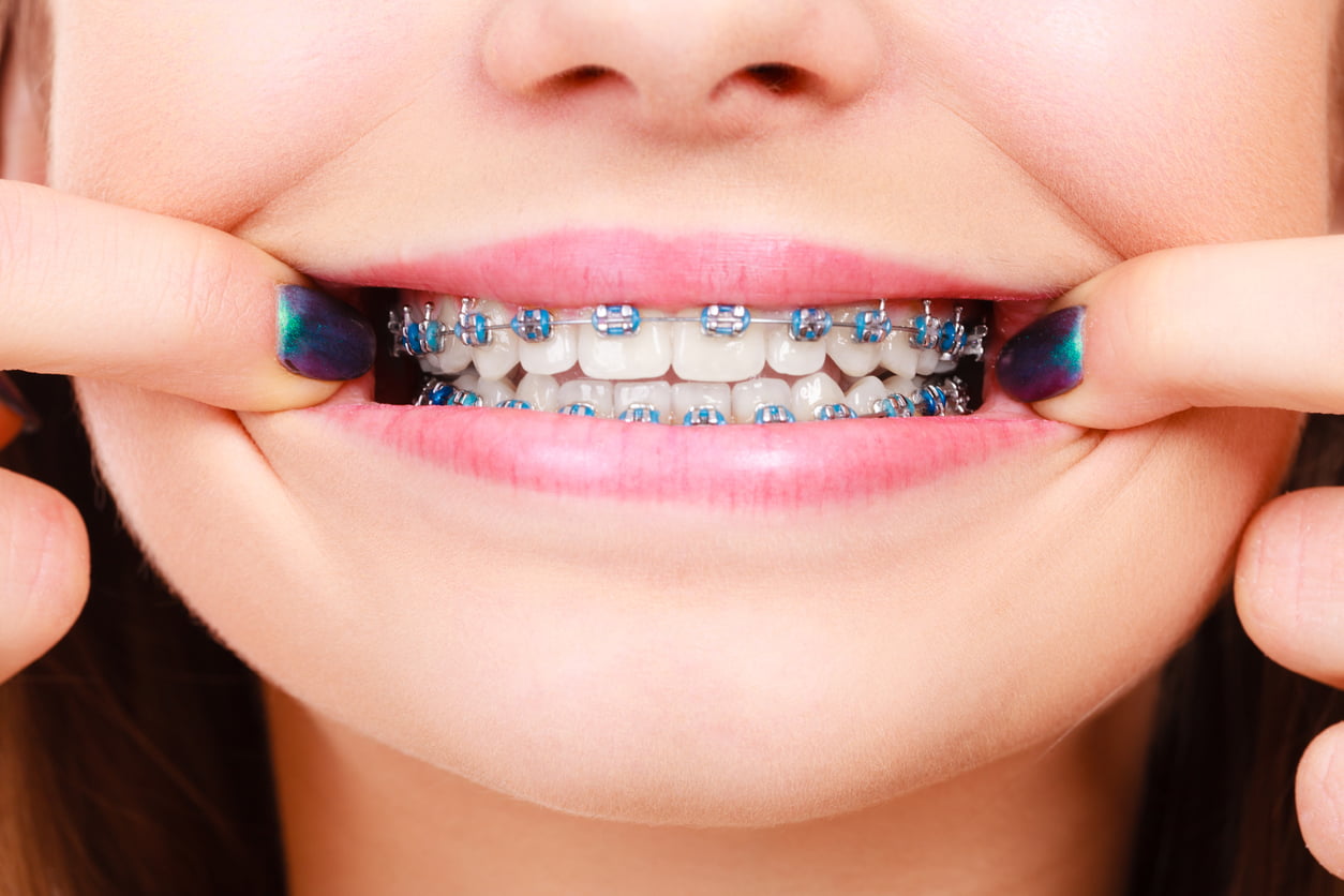 Dental merkez ağız ve diş sağlığı merkezi