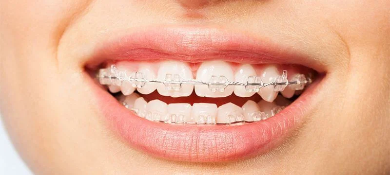 Dental merkez ağız ve diş sağlığı merkezi