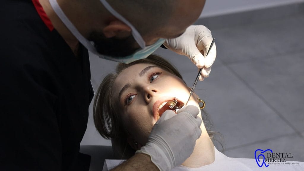 Gebze-dis-hastaneleri-2 dental merkez ağız ve diş sağlığı merkezi Dental merkez ağız ve diş sağlığı merkezi
