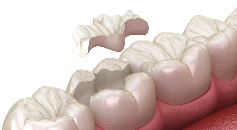 Dental merkez ağız ve diş sağlığı merkezi