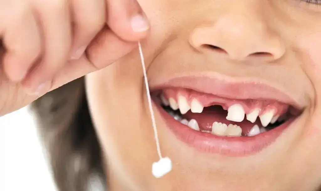 Sut-disi-cekimi dental merkez ağız ve diş sağlığı merkezi Dental merkez ağız ve diş sağlığı merkezi