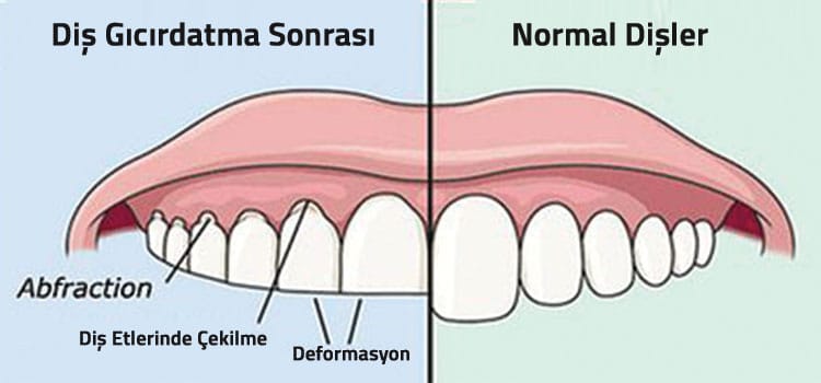 Dental merkez ağız ve diş sağlığı merkezi