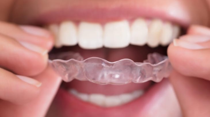 Dental merkez ağız ve diş sağlığı merkezi