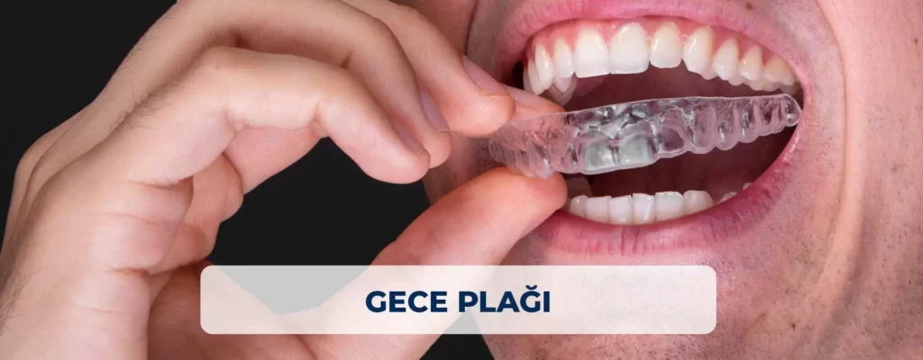 Gece Plağı Nedir, Ne İşe Yarar? (Diş Gıcırdatma)