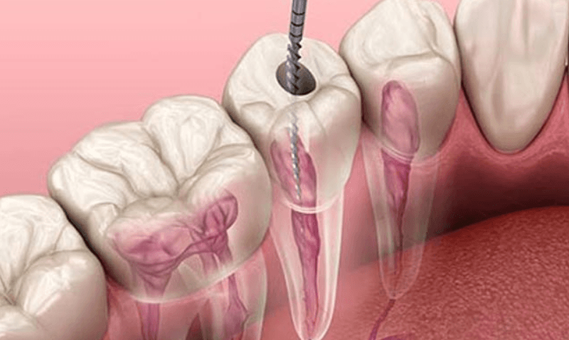 Dental merkez ağız ve diş sağlığı merkezi